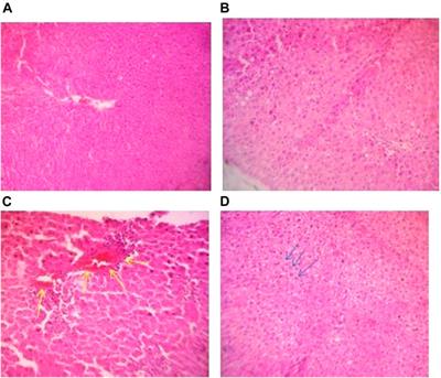 Assessment of toxicity and anti-plasmodial activities of <mark class="highlighted">chloroform</mark> fractions of Carapa procera and Alchornea cordifolia in murine models